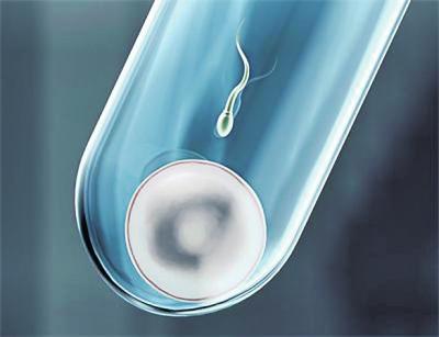 培养箱